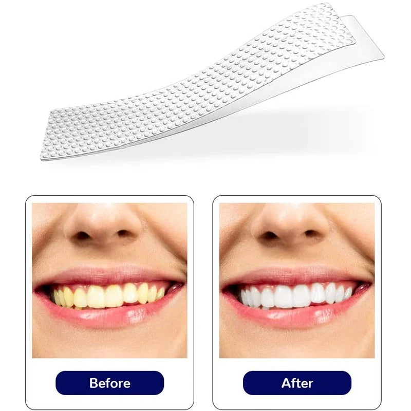  Pairs Gel Teeth Whitening Strips Stain Removal Oral Hygiene Care 